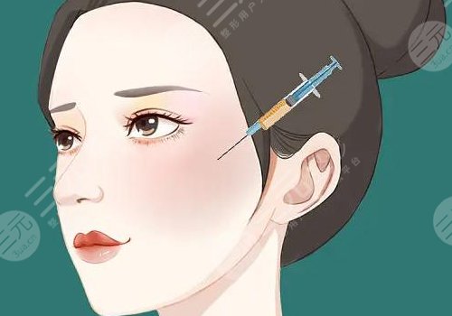 面部輪廓整形包括哪些種類(項(xiàng)目)？