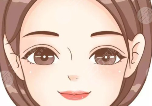 面部輪廓針是什么？