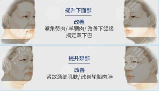 臉部吸脂加黃金微雕多少錢？價格表公開！緊致臉型攻略get~