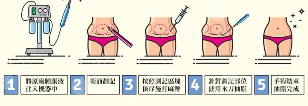 黃金微雕腰腹吸脂多久恢復(fù)？