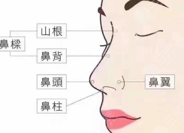 隆鼻