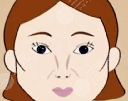 顴骨