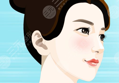 美國菲斯挺膨體適合放在鼻子哪里？