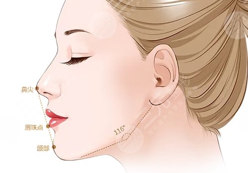 美國菲斯挺膨體適合放在鼻子哪里？