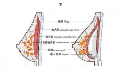 強(qiáng)生傲諾拉和曼托區(qū)別在哪？