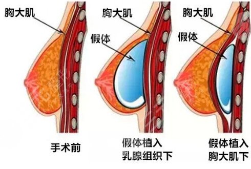 強(qiáng)生傲諾拉和曼托區(qū)別在哪？