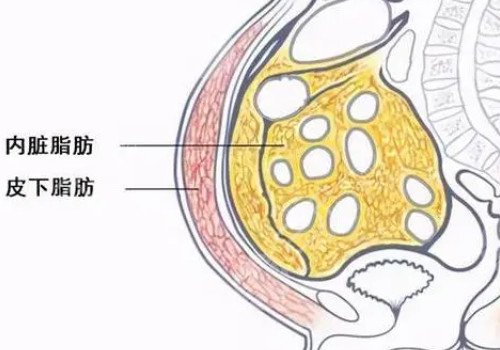 德國(guó)水動(dòng)力吸脂怎么樣？