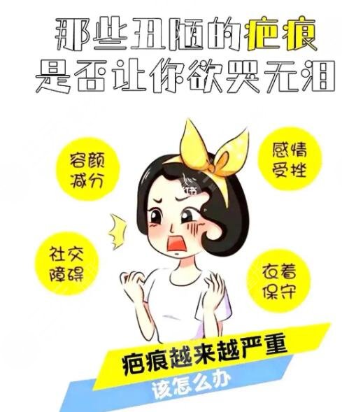 點痣后留下的疤痕多久恢復?
