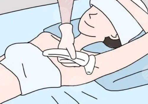 脫毛用哪種方法好？
