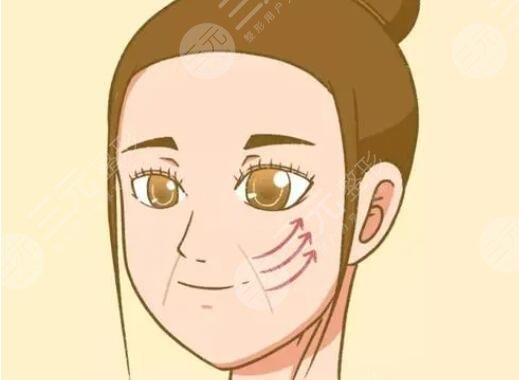 面部提升