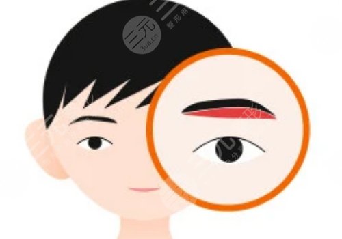 提眉的好處和壞處有什么？
