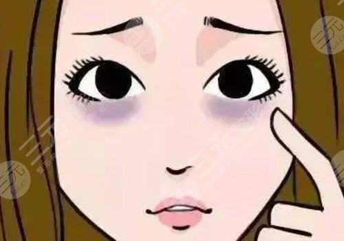 去黑眼圈的醫(yī)美項(xiàng)目多少錢？有哪些？