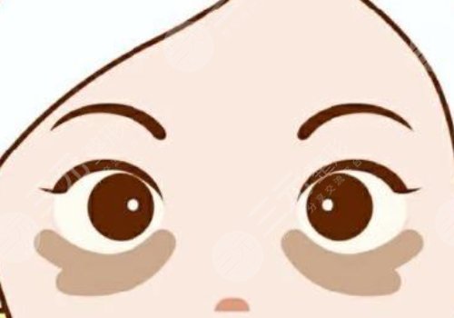 去黑眼圈的醫(yī)美項(xiàng)目多少錢？有哪些？