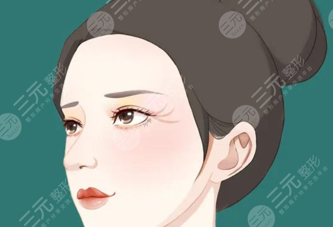 輪廓固定