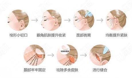 皮膚松弛下垂有什么辦法可以改良