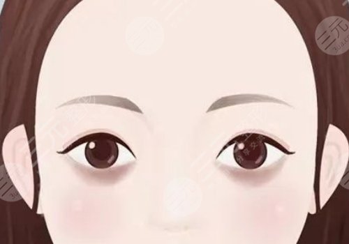 去黑眼圈手術(shù)多少錢啊？