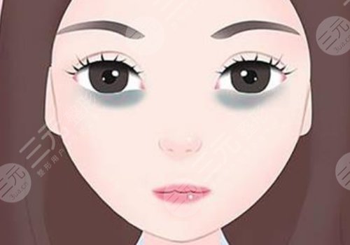 去黑眼圈手術(shù)多少錢??？