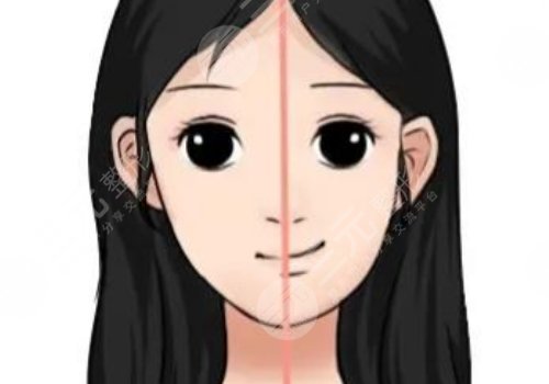 大小臉矯正手術(shù)有風(fēng)險(xiǎn)嗎？