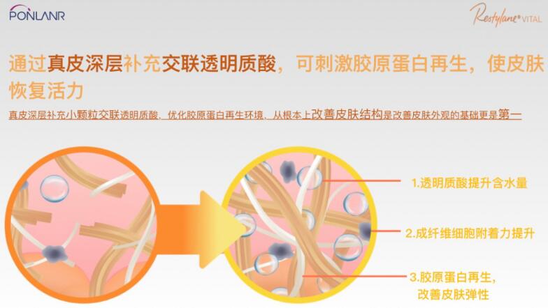 貴婦水光效果怎么樣？高奢維養(yǎng)，美膚指南！