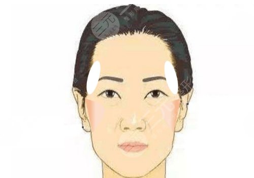中庭太長(zhǎng)怎么改良？
