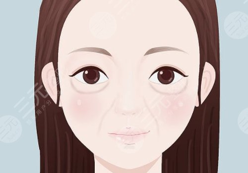 動(dòng)態(tài)紋和靜態(tài)紋哪個(gè)屬于真性皺紋？