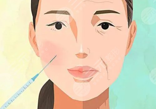 薇旖美可以注射眼部周圍的皺紋不？