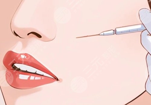 薇旖美可以注射眼部周圍的皺紋不？
