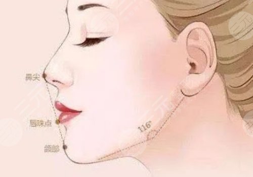 下頜緣提升有什么效果？