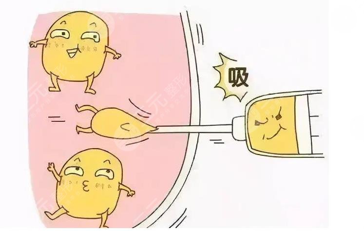 身體塑形能達(dá)到減肥的效果嗎？