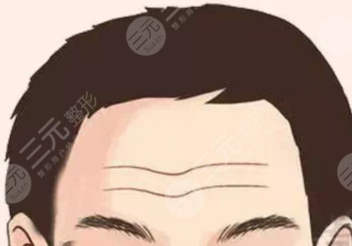 抬頭紋怎么去除有效男生？