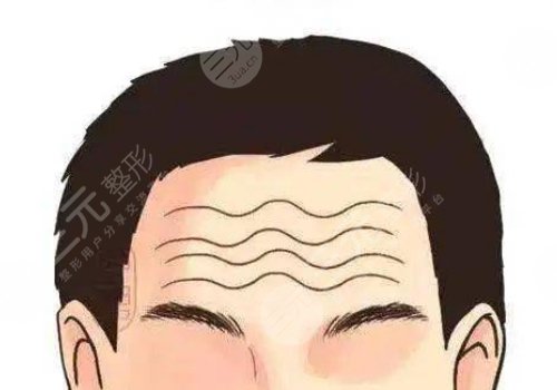 抬頭紋怎么去除有效男生？