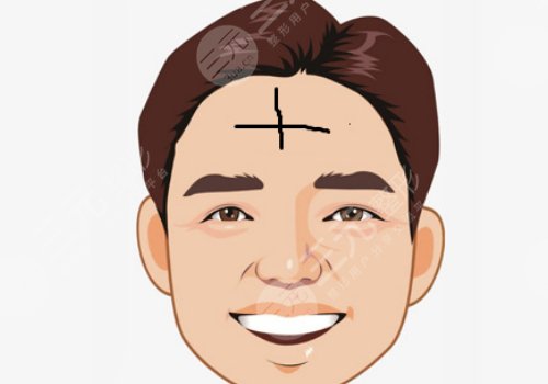 抬頭紋怎么去除有效男生？
