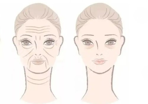 抬頭紋去除手術需要多少錢？