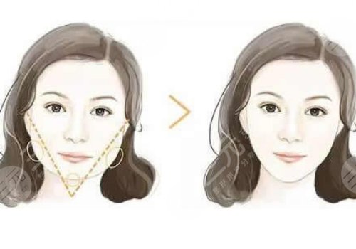 深圳美萊張華彬和黃海龍誰技術好？