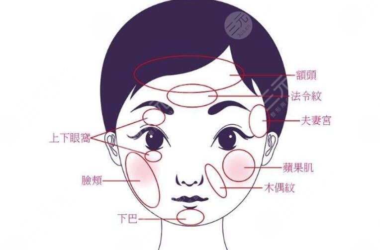 人工骨填充