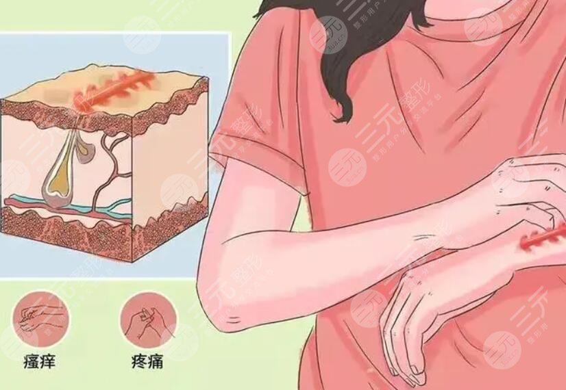 祛疤手臂