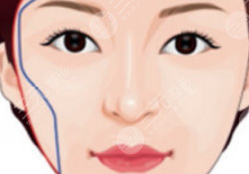 面部輪廓固定怎么做？
