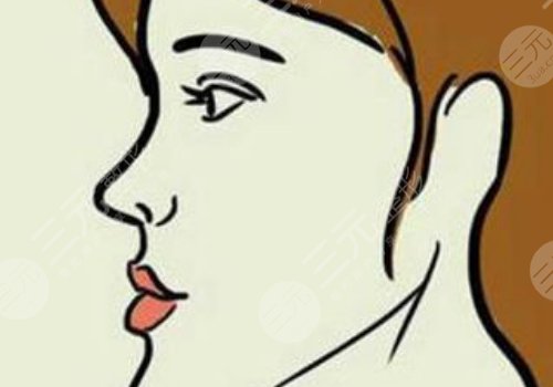 月亮臉矯正手術(shù)多少錢？