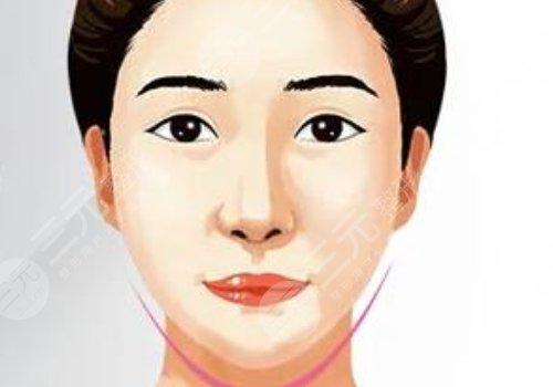 內外輪廓固定做手術要多久？