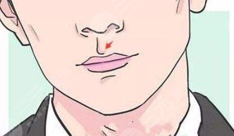 唇腭裂