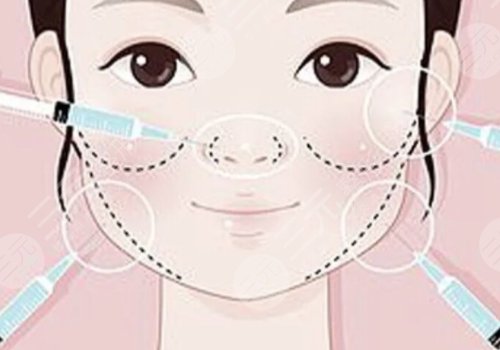 瑞藍玻尿酸打在哪個部位？