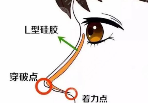 面部整形手術(shù)包括哪些？