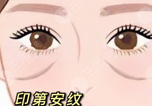 印第安紋和淚溝的區(qū)別是什么？