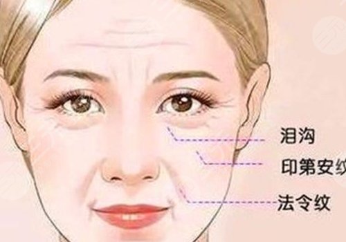 印第安紋和淚溝的區(qū)別是什么？