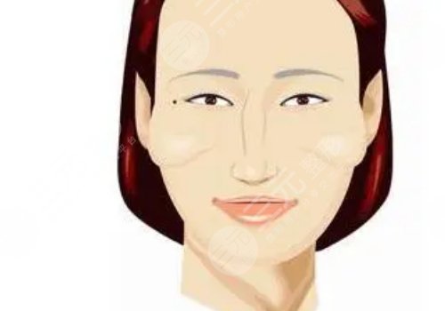 顴骨高怎么改良臉型？