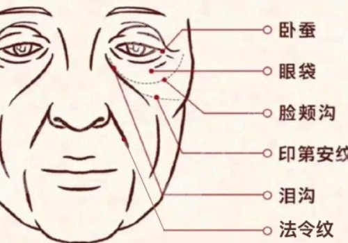 印第安紋填充膠原蛋白和玻尿酸哪個(gè)好？