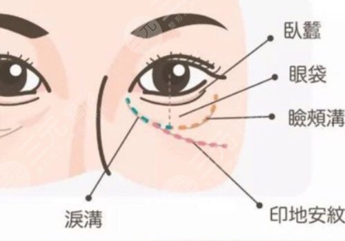 印第安紋填充膠原蛋白和玻尿酸哪個(gè)好？