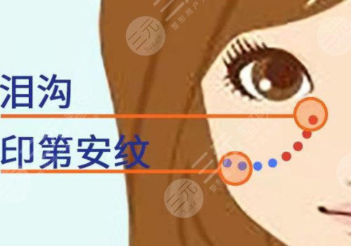 印第安紋填充膠原蛋白和玻尿酸哪個(gè)好？