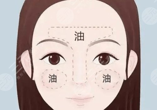 t區(qū)出油毛孔粗大什么原因？