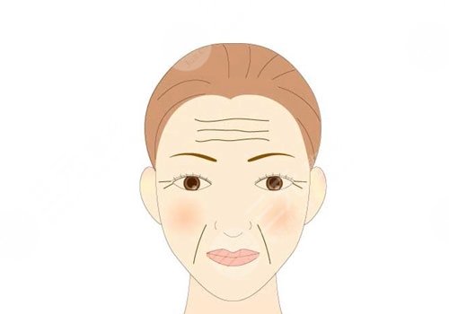 抬頭紋去除手術(shù)需要多少錢？